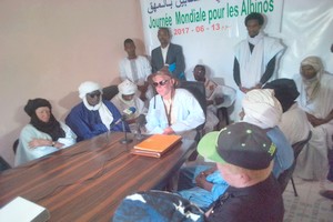 Les albinos de Mauritanie veulent se faire entendre [PhotoReportage]
