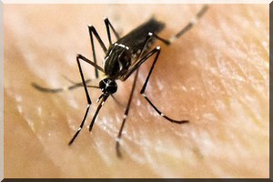 Zika : première naissance en Europe d'un bébé atteint de microcéphalie