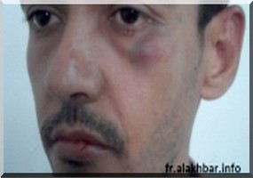 Violence contre les journalistes : Assourdissant silence de la HAPA.  
