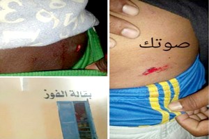 Photos des blessés de l’agression à l’arme blanche de l’épicerie El Vaouz à Riyad