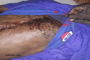 Winding: Abass Diallo tué à bout portant par l’armée, l'AMDH dénonce une dynamique répressive dans la Vallée