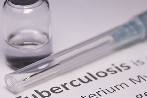 Afrique du Sud : un nouveau traitement plus rapide contre la tuberculose