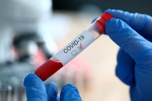 Coronavirus :