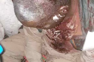Mauritanie – Droits de l’homme : Des esclaves battus à mort par leurs maîtres