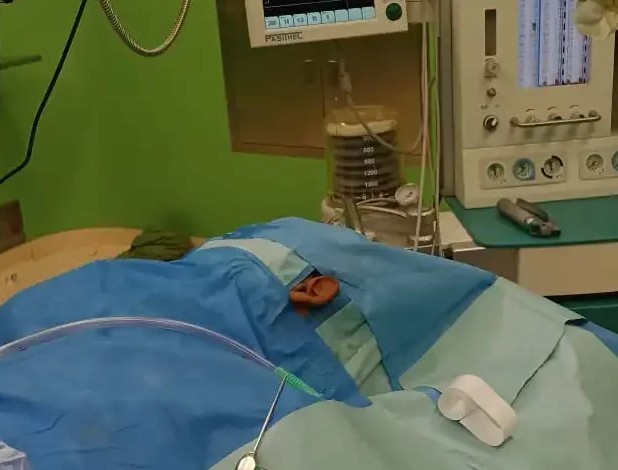 Hôpital de l’Amitié: l’équipe ORL réalise une première chirurgie endoscopique de l’oreille