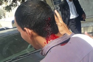 Nouakchott : Plusieurs blessés dans la dispersion d’une manifestation de bacheliers