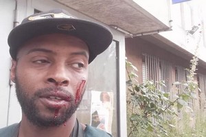 L’artiste mauritanien Oumzo victime d’une agression