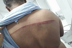 Des voleurs s’attaquent à une pharmacie, blessent son gérant et lui soutirent son argent (Photos)