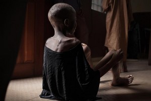 Santé: un jeune enfant sur trois est mal nourri ou en surpoids selon l’Unicef