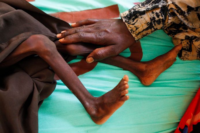 Situation catastrophique dans le nord-est de l’Afrique: pas moins de 60 millions de personnes risquent de mourir de faim